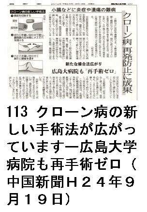 113 クローン病の新しい手術法が広がっていますー広島大学病院も再手術ゼロ（中国新聞Ｈ２４年９月１９日）