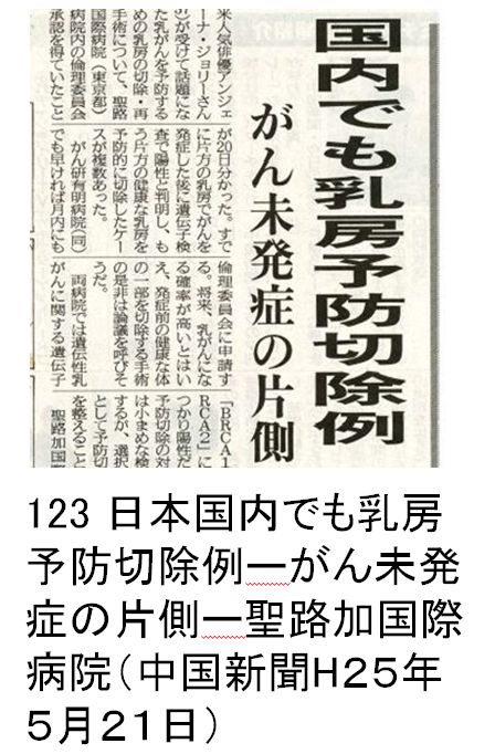 123 日本国内でも乳房予防切除例ーがん未発症の片側ー聖路加国際病院（中国新聞H２５年５月２１日）